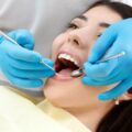 Dental Scaling