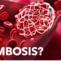 Thrombosis